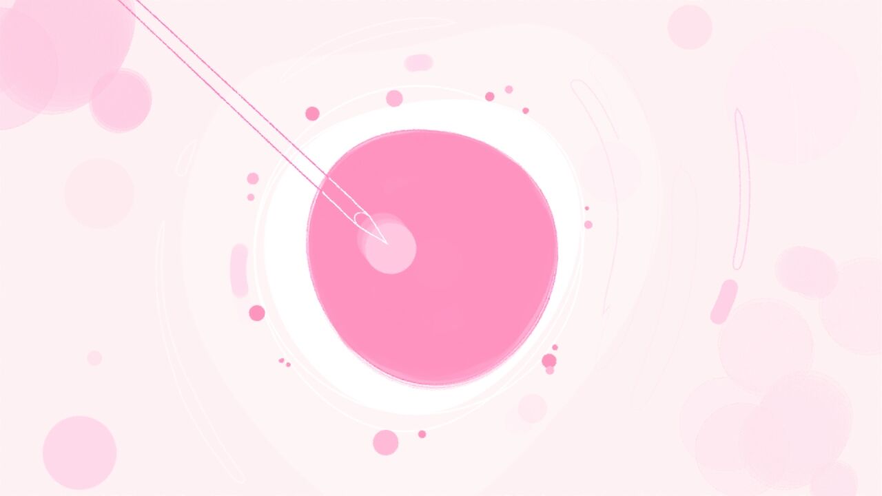 project-img